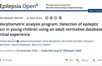 Morphometric analysis program: Detection of epileptic foci in young children using an adult normative database: Initial experience
